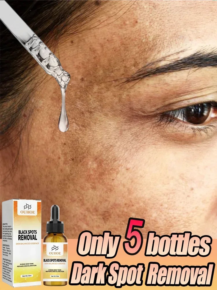 Vitamina C do Retinol A niacinamida ilumina o soro, pele, melanina, essência facial, remoção do ponto do alvejante, ilumina, melanina, cloasma